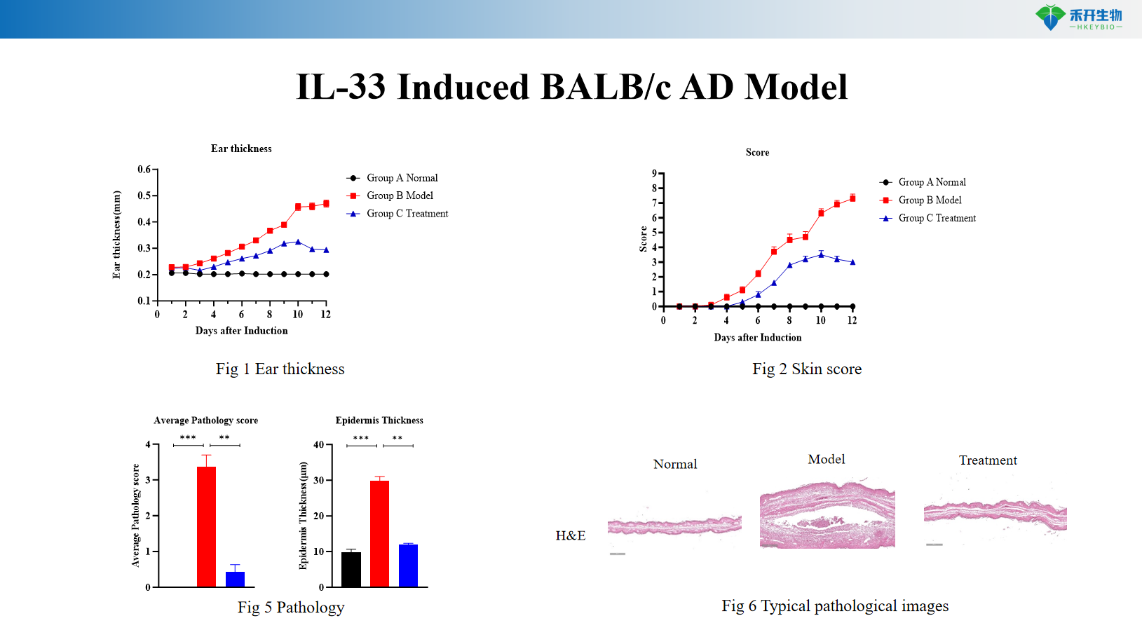IL-33 Induced BALB/c AD Model 11