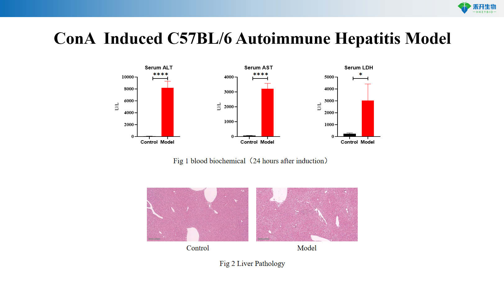 ConA Induced C57BL/6 Autoimmune Hepatitis Model 1
