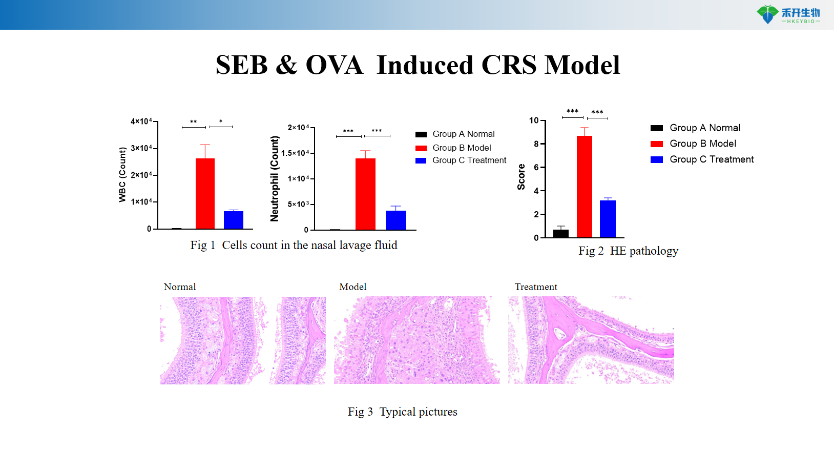 SEB & OVA Induced CRS Model 4