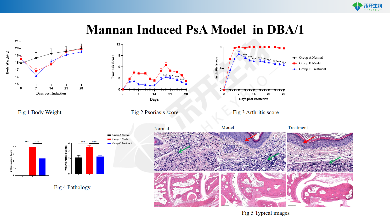 Mannan Induced PsA Model in DBA/1 1