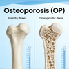 Rodent Osteoporosis (OP) ပုံစံများ