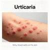 Модели уртикарије глодара
