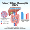 Mouse Primary Biliary Cholangitis (PBC) Models