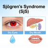 NHP Sj&ouml;gren's Syndrome (SjS) Models