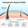 Androgenetische Alopezie (AGA)-Modelle bei M&auml;usen