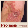 NHP Psoriase Modelle
