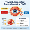 Mouse Thyroid Associated Ophthalmopathy (TAO) မော်ဒယ်များ