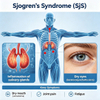 Mouse Sj&ouml;gren's Syndrome (SjS) ပုံစံများ