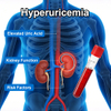 မောက်စ် Hyperuricemia မော်ဒယ်များ