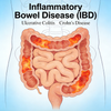 NHP Inflammatory Bowel Disease (IBD) Models