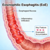 Mouse Eosinophilic Esophagitis (EoE) Models