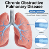NHP Chronic Obstructive Pulmonary Disease (COPD) Models